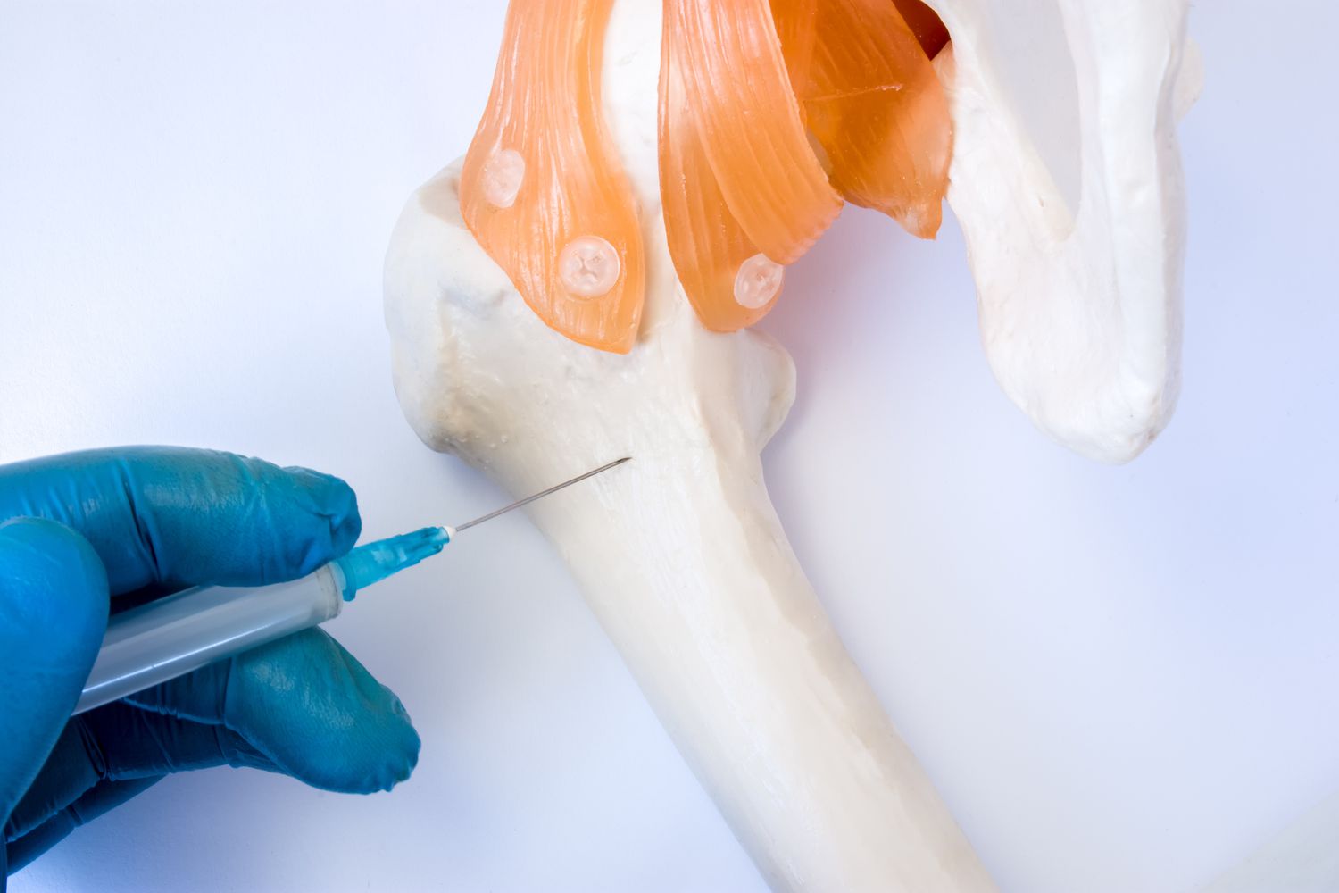 Bone Marrow