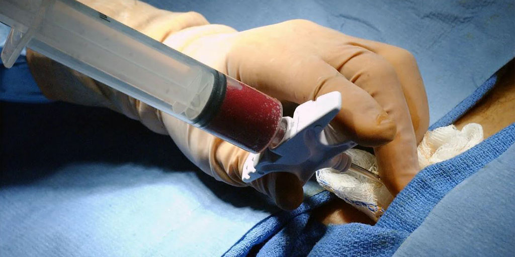 Is Bone Marrow Donation Painful