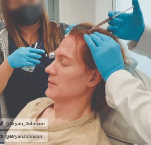 Bryan Johnson getting Blueprint hair care treatment